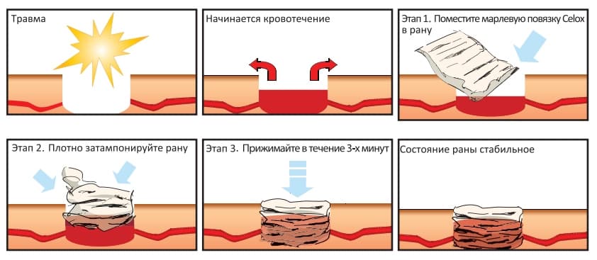 Кровоостанавливающие таблетки без рецепта. met prim pov. Кровоостанавливающие таблетки без рецепта фото. Кровоостанавливающие таблетки без рецепта-met prim pov. картинка Кровоостанавливающие таблетки без рецепта. картинка met prim pov. Сеть аптек 36,6 даёт приобрести кровоостанавливающие препараты по выгодной цене с возможностью доставки в одной из 1200 аптек Москвы и Санкт-Петербурга, Московской и Ленинградской областей. Поиск необходимого лекарства заметно упрощается благодаря тому, что искать средство можно по цене, производителю, форме выпуска и основному компоненту.