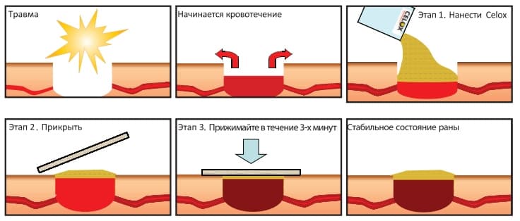 Кровоостанавливающие таблетки без рецепта. met prim sel. Кровоостанавливающие таблетки без рецепта фото. Кровоостанавливающие таблетки без рецепта-met prim sel. картинка Кровоостанавливающие таблетки без рецепта. картинка met prim sel. Сеть аптек 36,6 даёт приобрести кровоостанавливающие препараты по выгодной цене с возможностью доставки в одной из 1200 аптек Москвы и Санкт-Петербурга, Московской и Ленинградской областей. Поиск необходимого лекарства заметно упрощается благодаря тому, что искать средство можно по цене, производителю, форме выпуска и основному компоненту.
